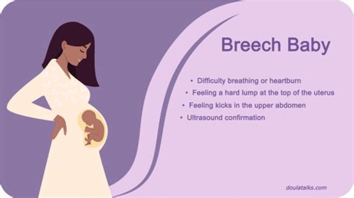 Are breech births dangerous?