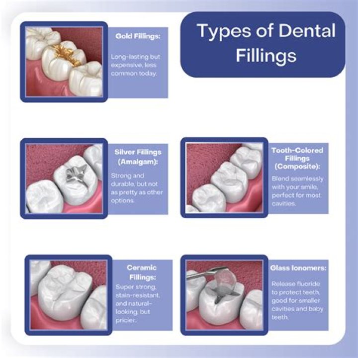 Are cavity fillings noticeable?