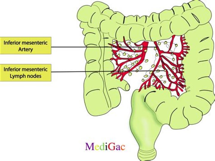 Are mesenteric lymph nodes dangerous?