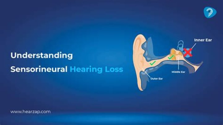 Are there hearing aids for nerve deafness?