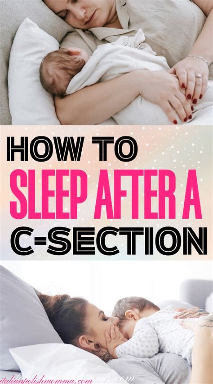 Are you asleep during cesarean?