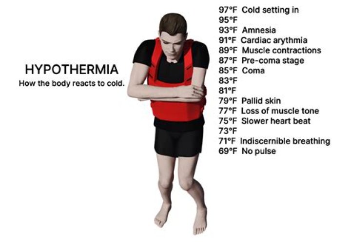 At what body temperature does hypothermia set in?