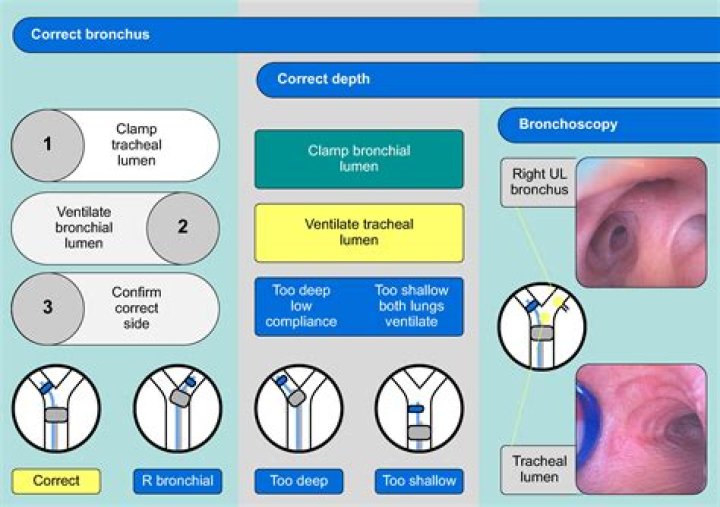 Can bronchial tubes collapse?