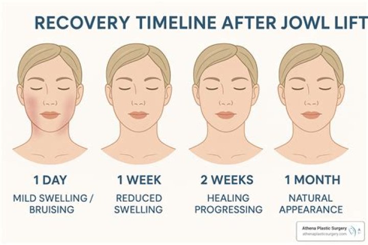 Can jowls be removed?