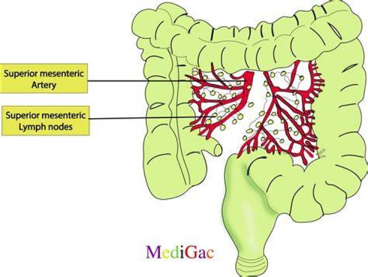 Can mesenteric adenitis lead to cancer?