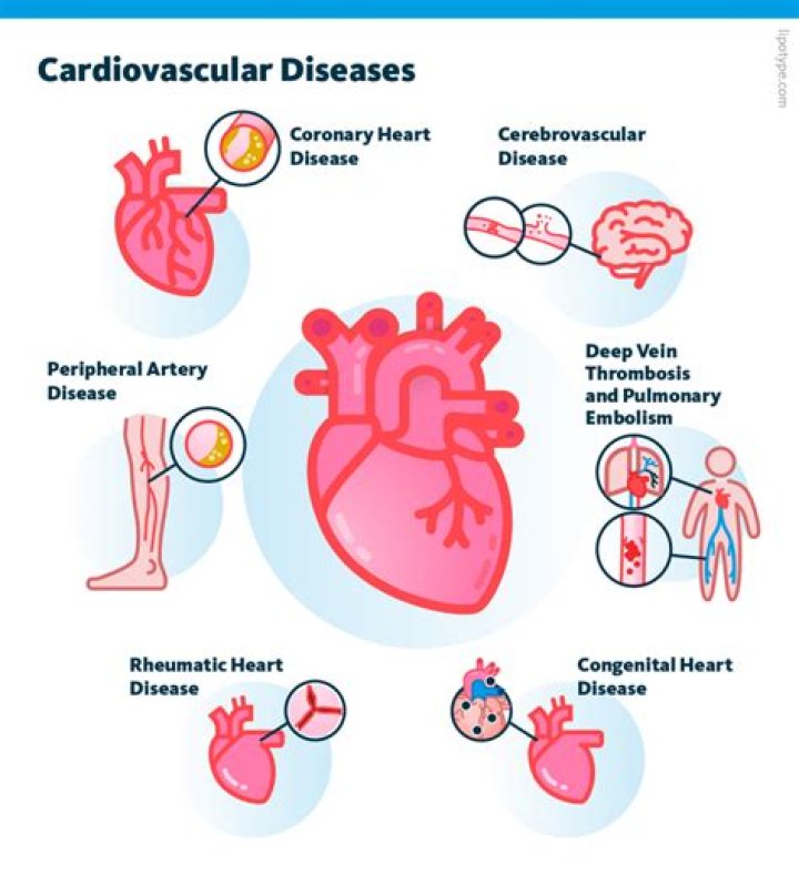 Can you die from cerebrovascular?
