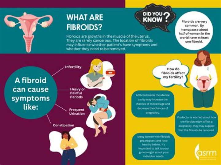 Can you feel a submucosal fibroid?