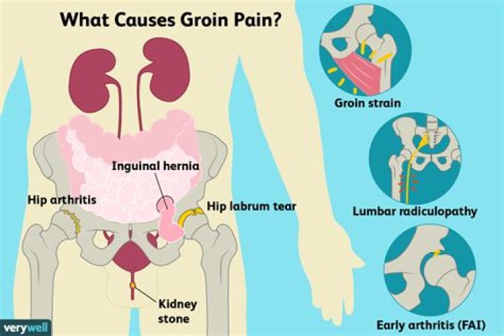 Could groin pain be cancer?