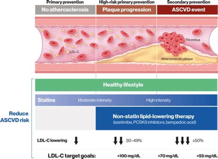 Do statins calcify plaque?