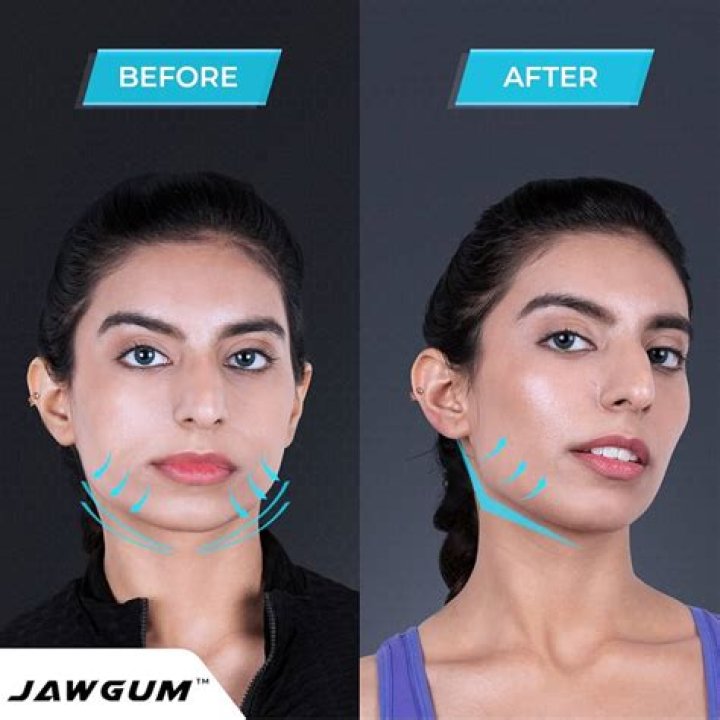 Does chewing gum reduce face fat?