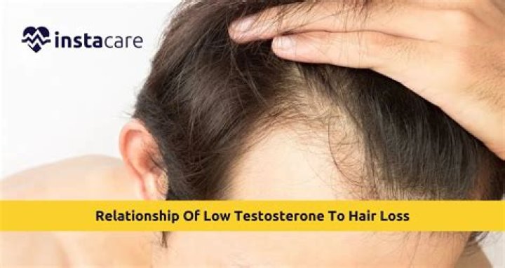 Does excess testosterone cause hair loss?