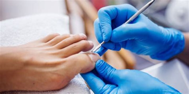 Does vicks soften toenails?