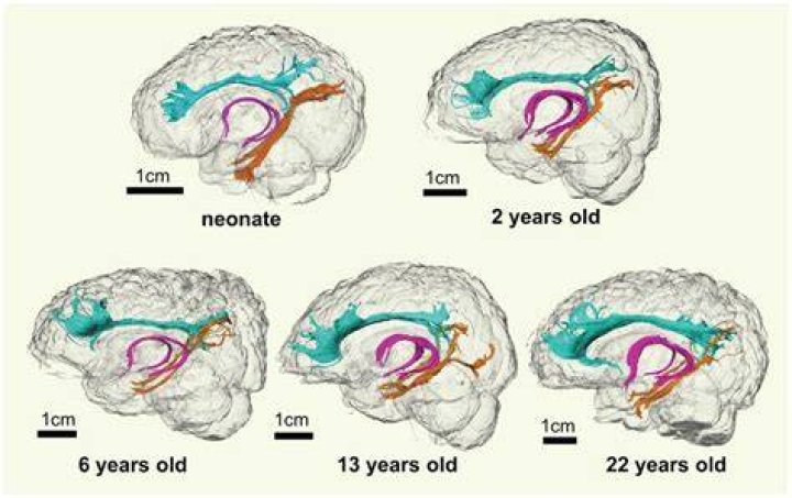 During puberty different parts of the brain grow at?