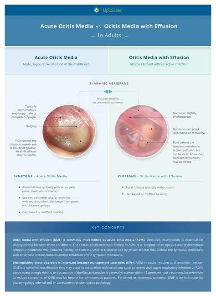 Has acute otitis media?