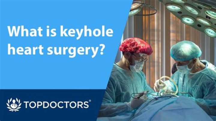 How do keyholes work?