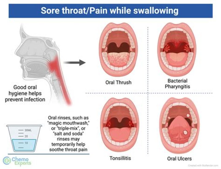 How does a swollen throat look like?