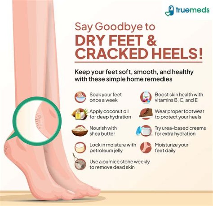 How to cure rough dry cracked feet?