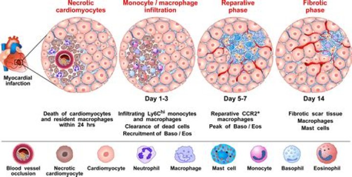 Increase in basophil count indicates?