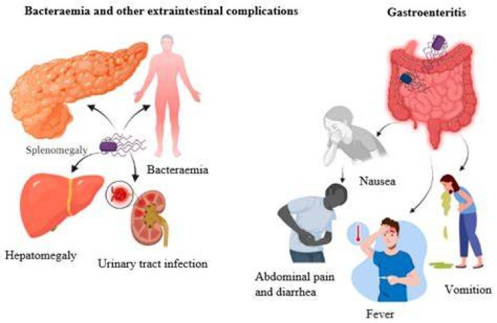 Is bacteremia a disease?