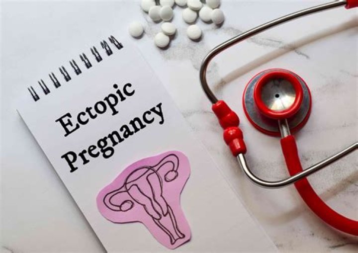 Is ectopic pregnancy rare?