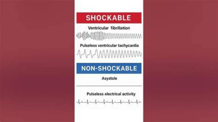 Is shockable and adjective?