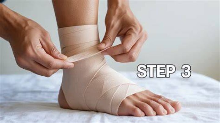 Should i wrap my ankle after a sprain?
