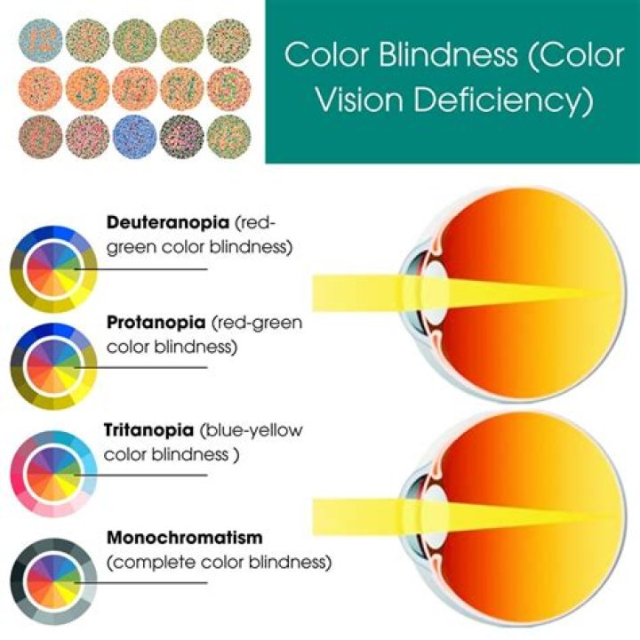What causes blue-yellow color blindness?
