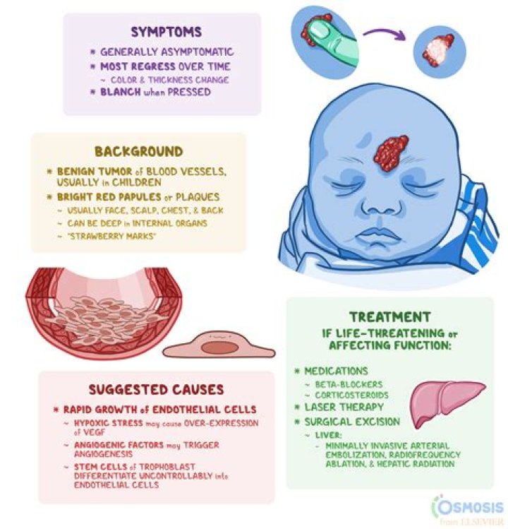What causes infantile systemic hyalinosis?