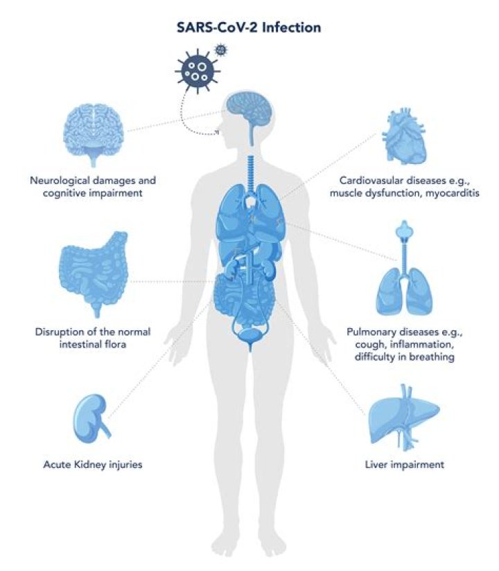 What is covid 19 symptomatic?