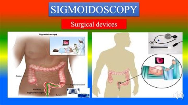 What is the medical definition for sigmoiditis?