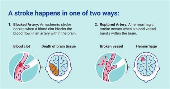 What usually happens after a stroke?