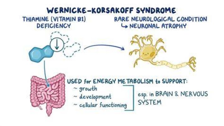 When does wernicke area develop?