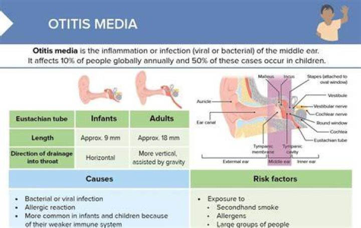 When to treat otitis media?