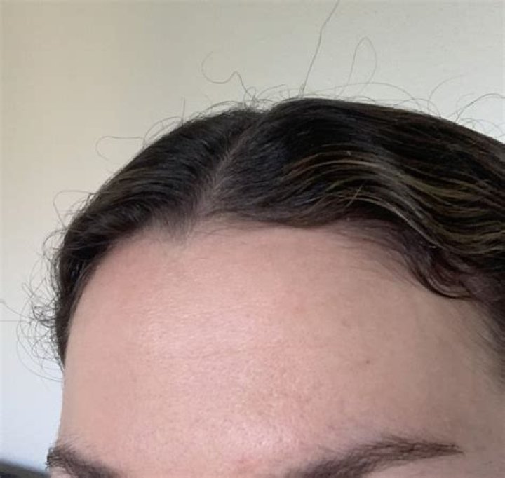 When whiteheads won't go away?