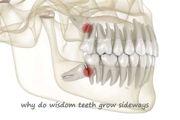 When wisdom teeth grow?