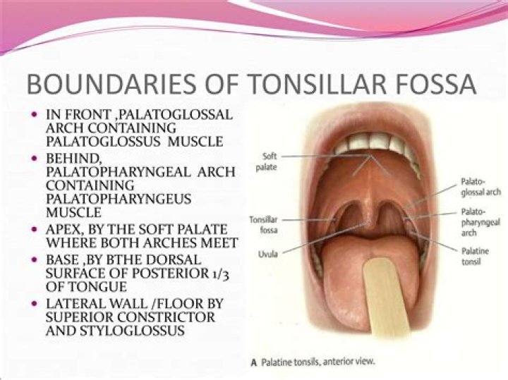Where is cerebellar tonsillar?