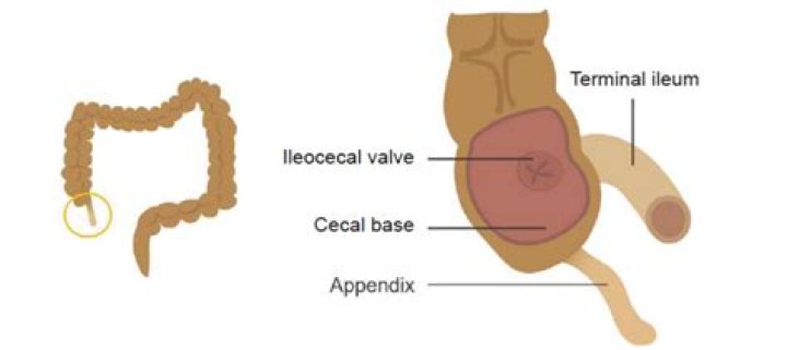 Where is ileocaecal valve?