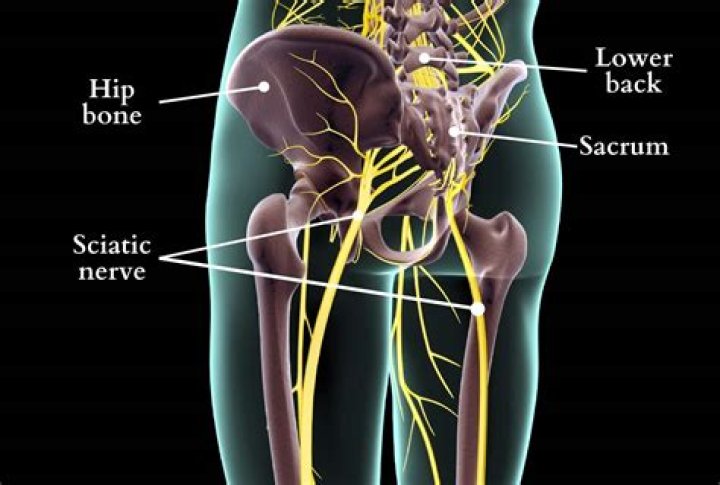 Where is the sciatic nerve located?