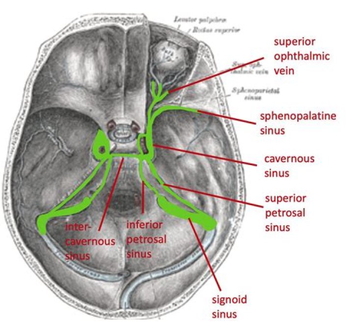 Where is the sphenoparietal suture?