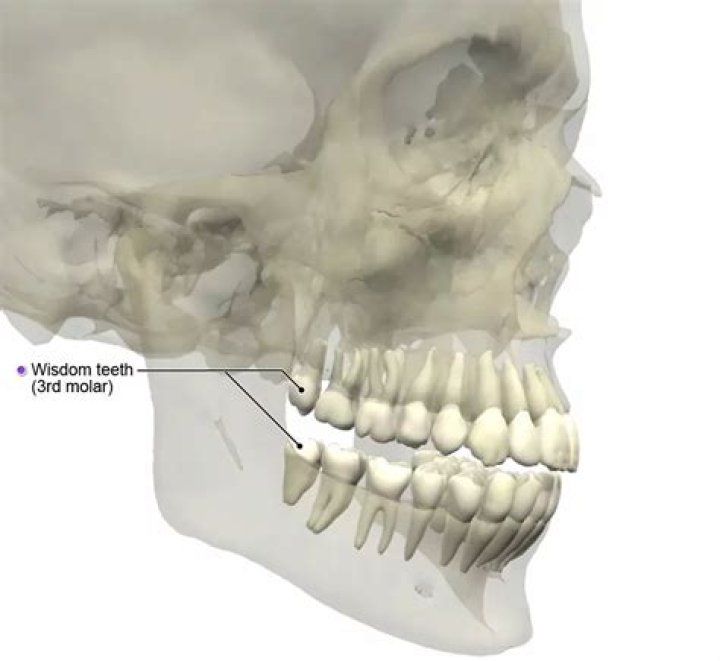Where wisdom teeth are located?