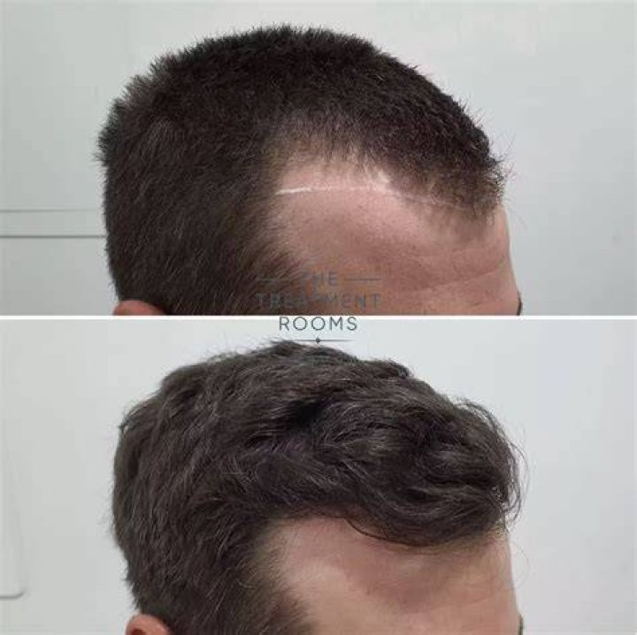Who is a hair-raising?