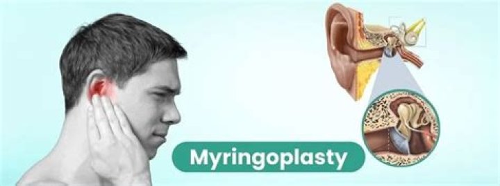 Why is myringoplasty performed?