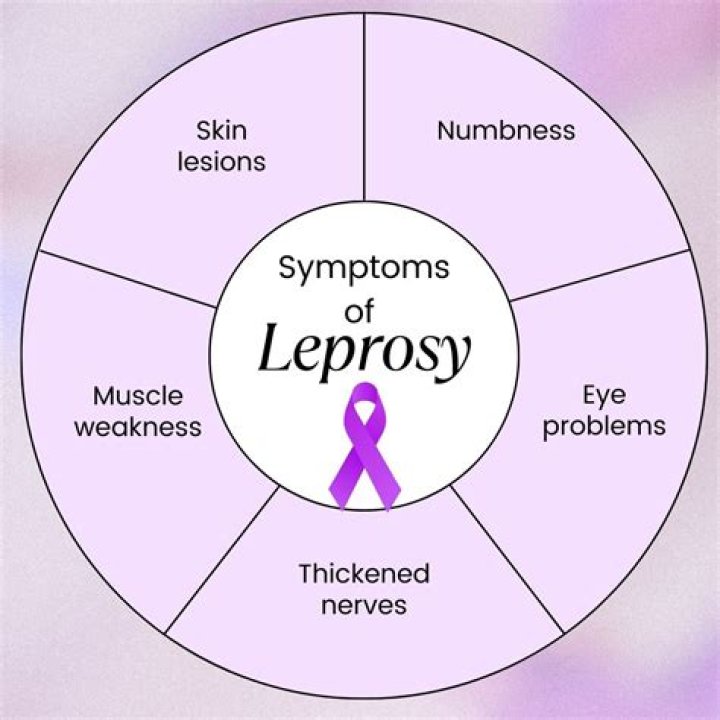 Why leprosy is called social disease?