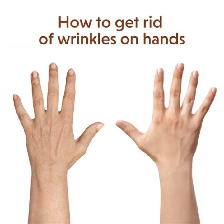 Why wrinkles on hands?