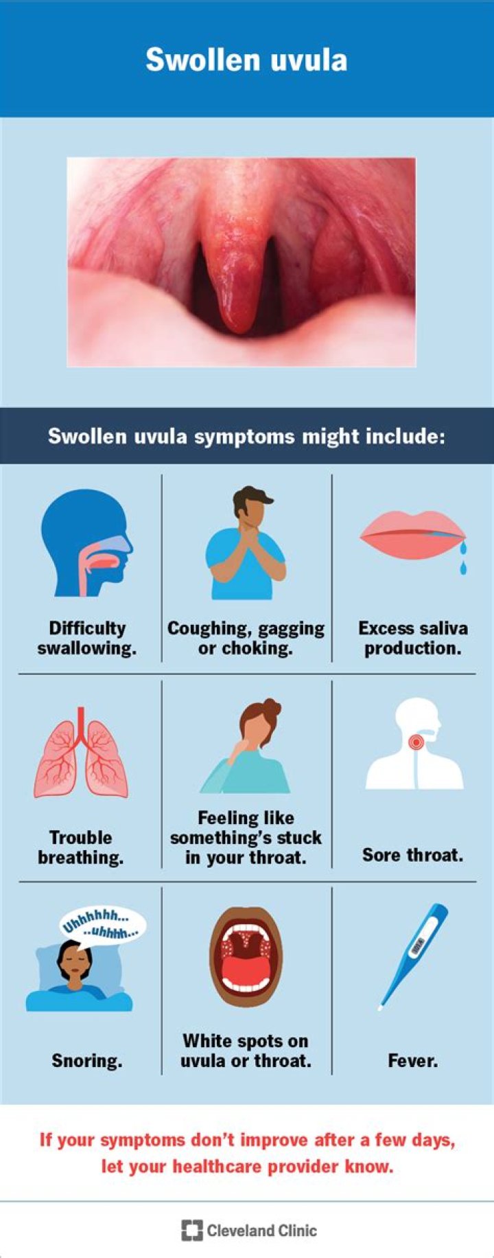 Will benadryl help a swollen throat?