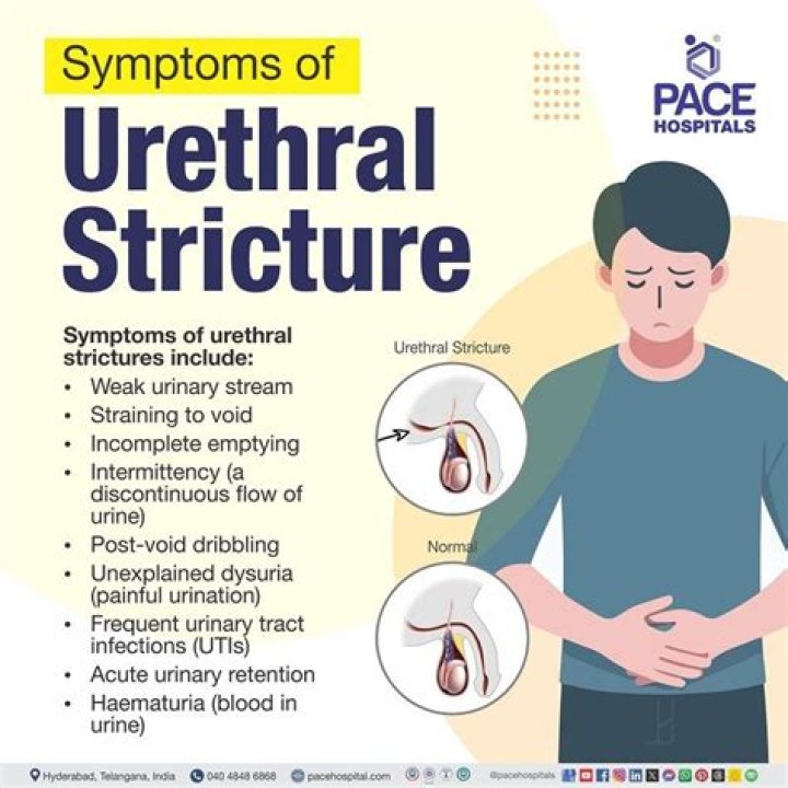 Will urethral irritation go away?