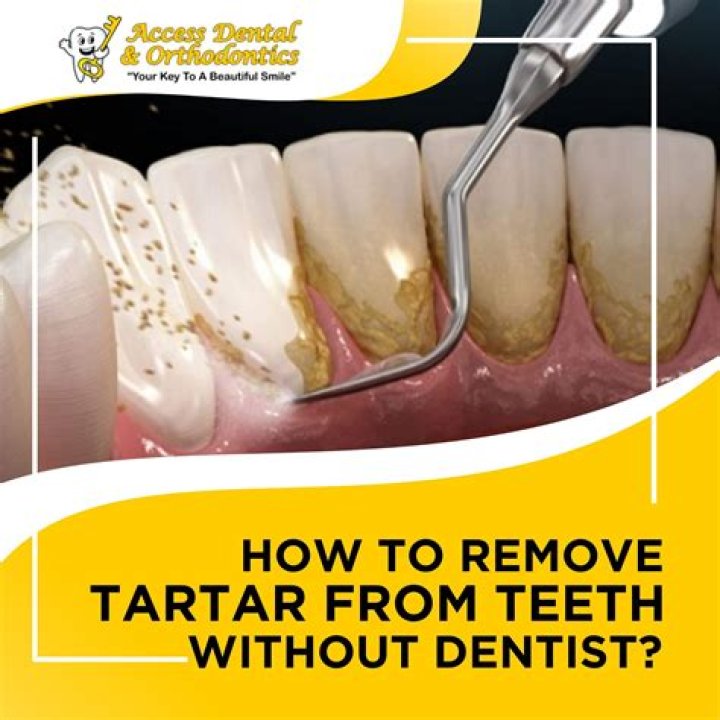 Will vinegar remove tartar from teeth?
